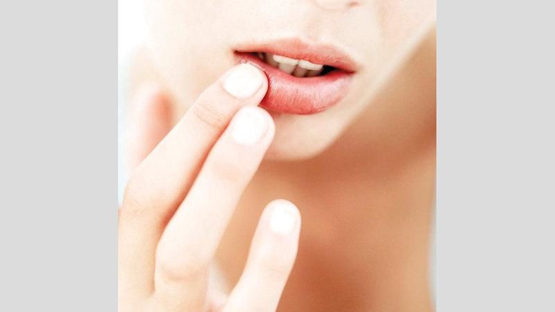 لماذا تتشقق الشفاه في الشتاء؟