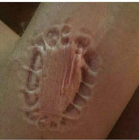 طائرة تغير وجهتها بسبب “عضة”!