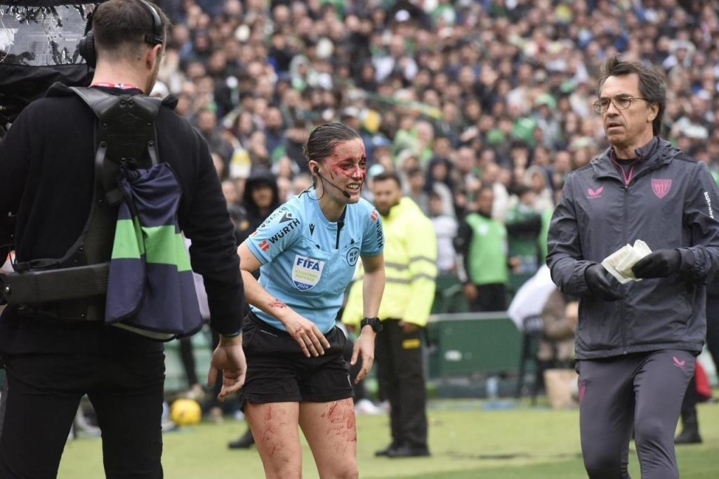 حكمة تتعرض إلى أغرب إصابة في الملاعب (صور)