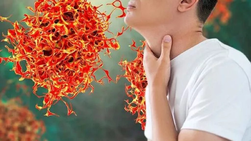 علامات مفاجئة لسرطان الرئة يجب معرفتها