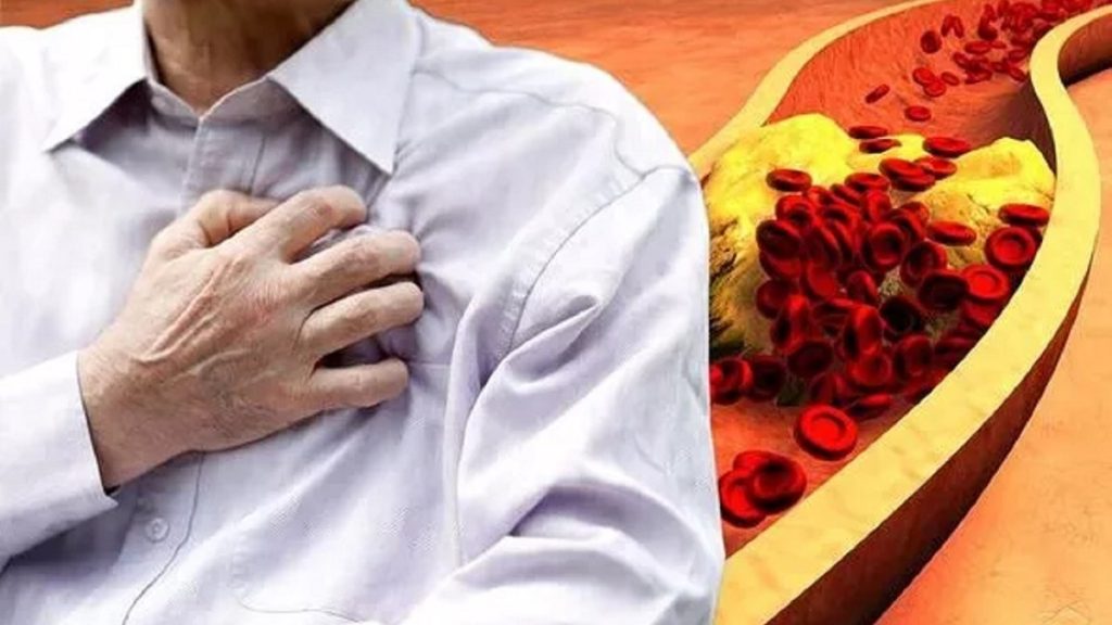 تحذير إلى أصحاب الكوليسترول المرتفع.. انتبهوا إلى هذه الأطعمة لأجل صحتكم