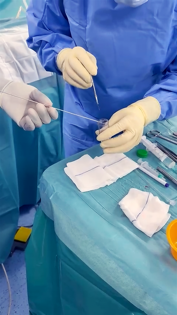 أطباء “دبي الصحية” ينجحون في أخذ خزعة من ورم عميق داخل دماغ مريضة باستخدام تقنيات الذكاء الاصطناعي