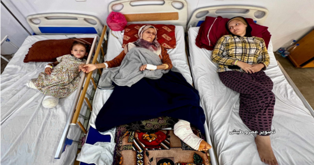 الحرب على غزة… بتر وإعاقات وجحيم لا يُطاق