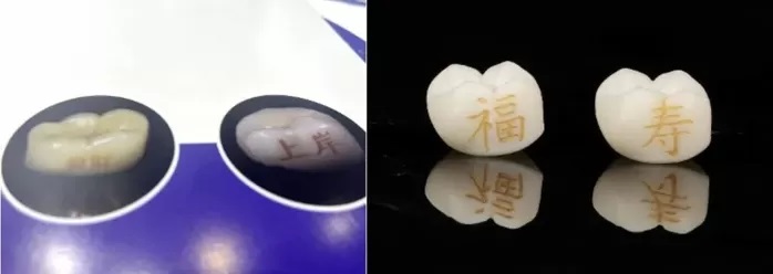 صيحة صينية جديدة وشم الأسنان بدل الجلد