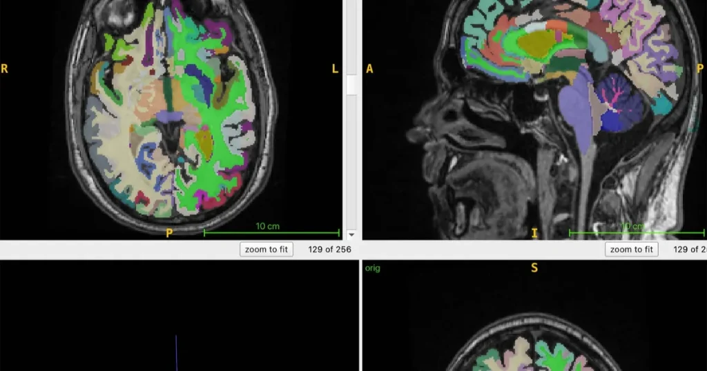اكتشاف آلية جديدة لوصول الهرمونات إلى الدماغ